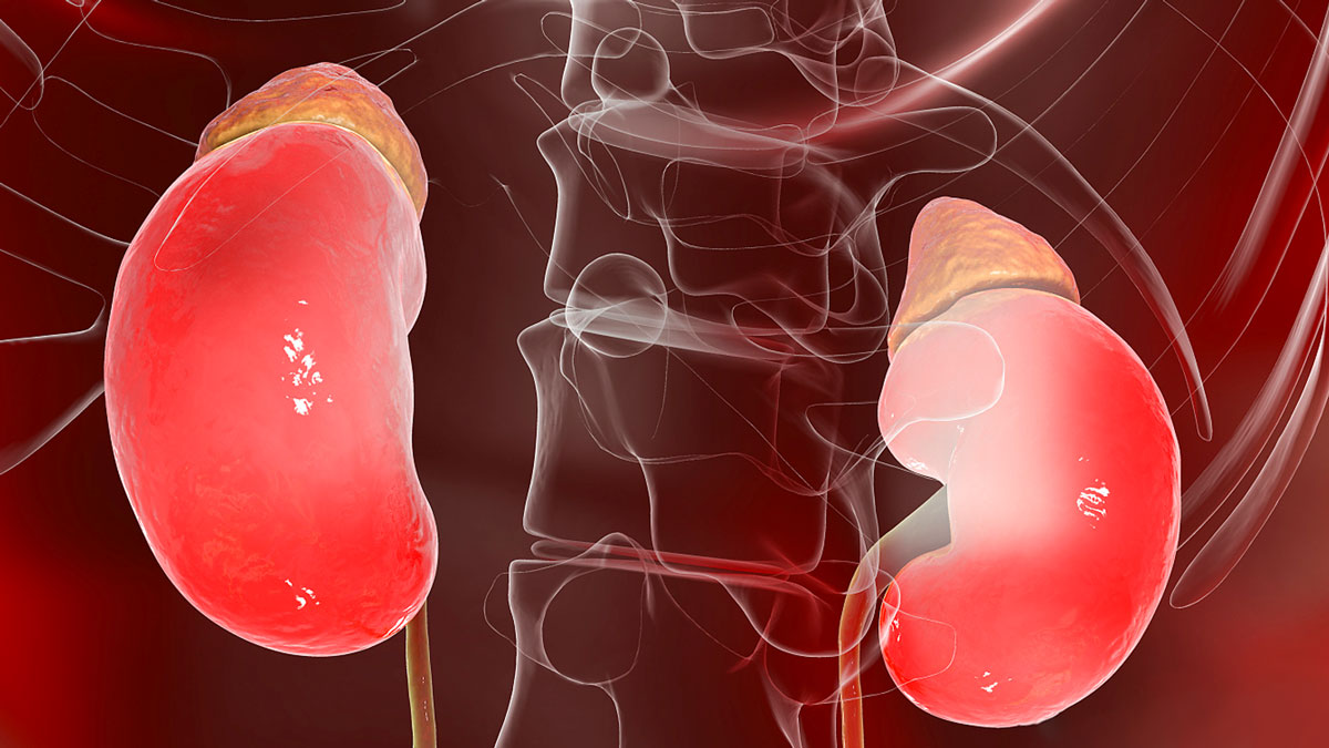 干細(xì)胞治療急性腎損傷中的臨床研究