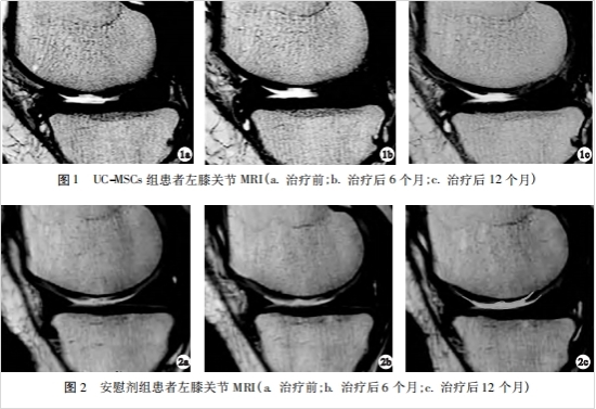 干細(xì)胞移植