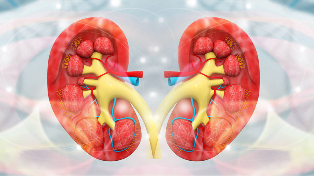 12例干細胞移植狼瘡性腎炎中的研究