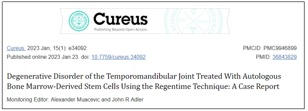 Cureus期刊最新報道：干細胞治療1例下頜關節(jié)退行性疾病，隨訪顯示完全康復